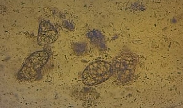 Результаты анализов кала на яйца глист под микроскопом