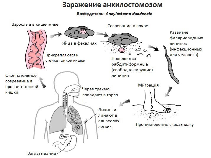 Схема заражения анкилостомозом