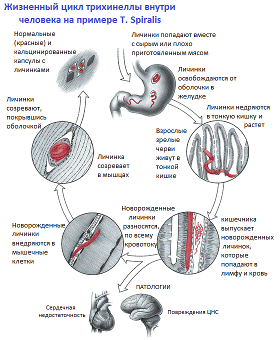 Схема жизненного цикла трихинеллы внутри человека