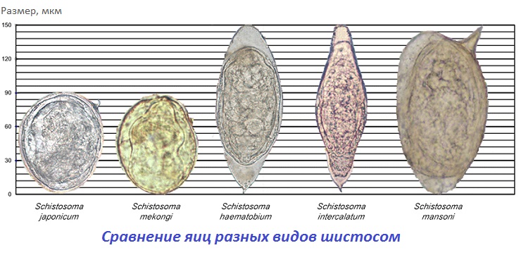Сравнение яиц разных видов шистосом