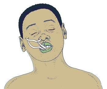 Выход глистов через рот и нос у человека (рисунок)