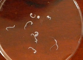 Schistosoma bovis 