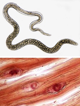 Самка и личинки Trichinella spiralis