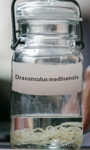 Dracunculus medinensis в банке
