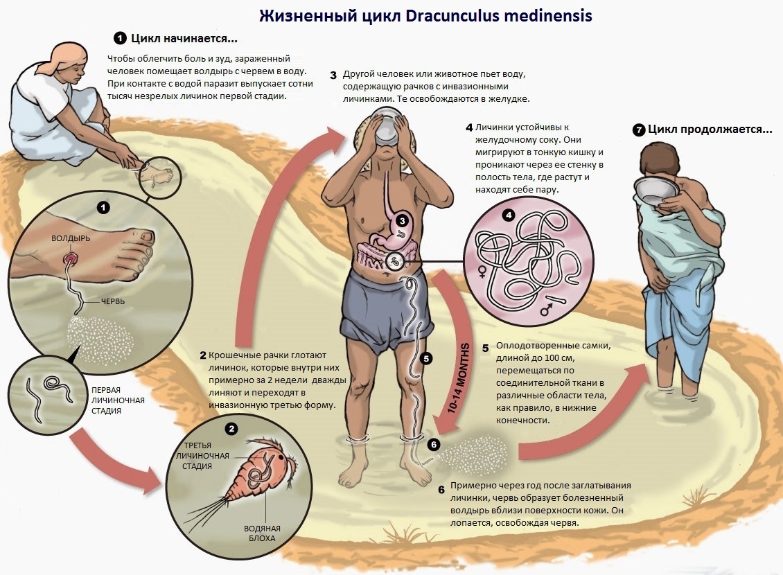 Жизненный цикл Dracunculus medinensis